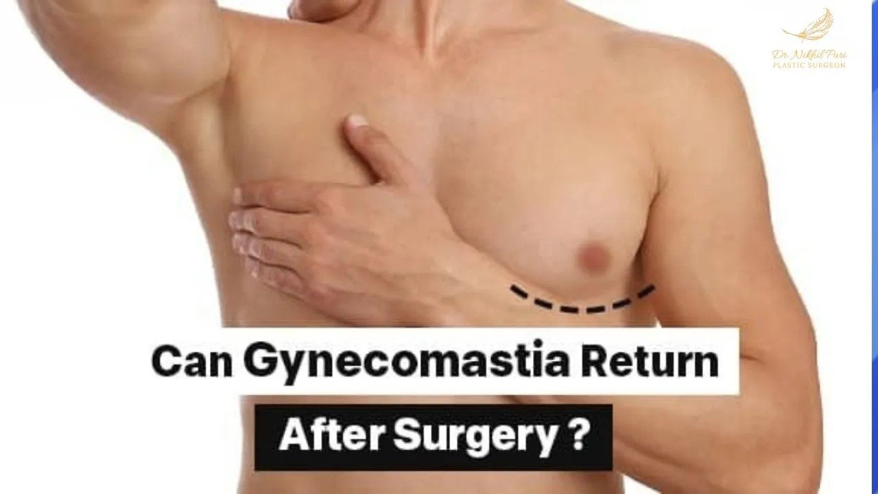 Gynecomastia Doctor Near Me