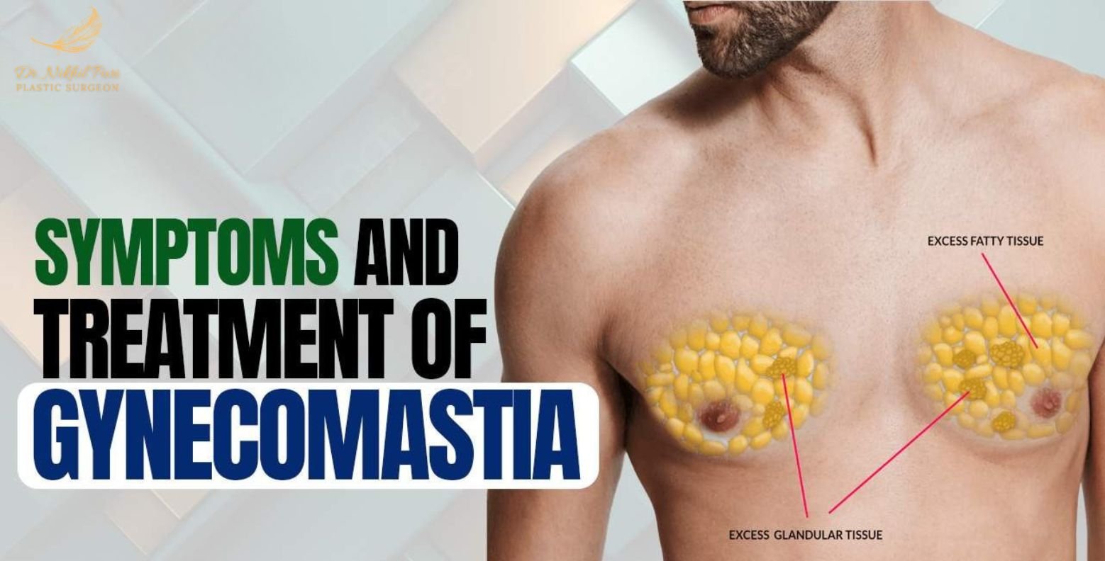 Gynecomastia Treatment | Best Plastic Surgeon in Lucknow