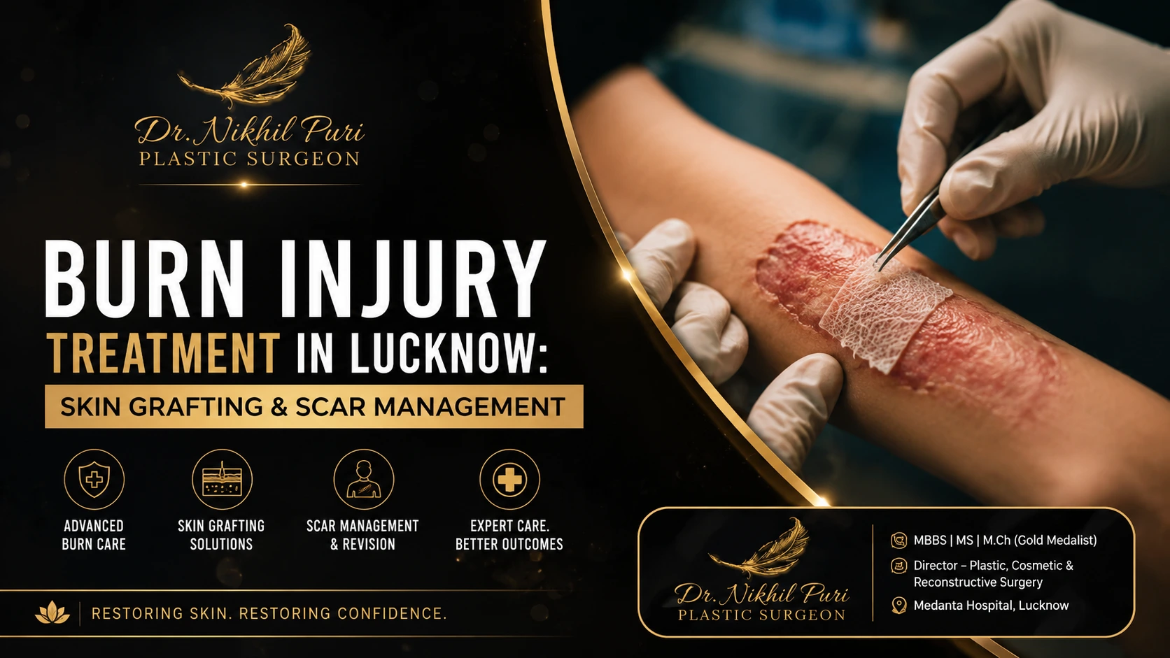 Burn injury treatment in Lucknow with skin grafting and scar management by a plastic surgeon